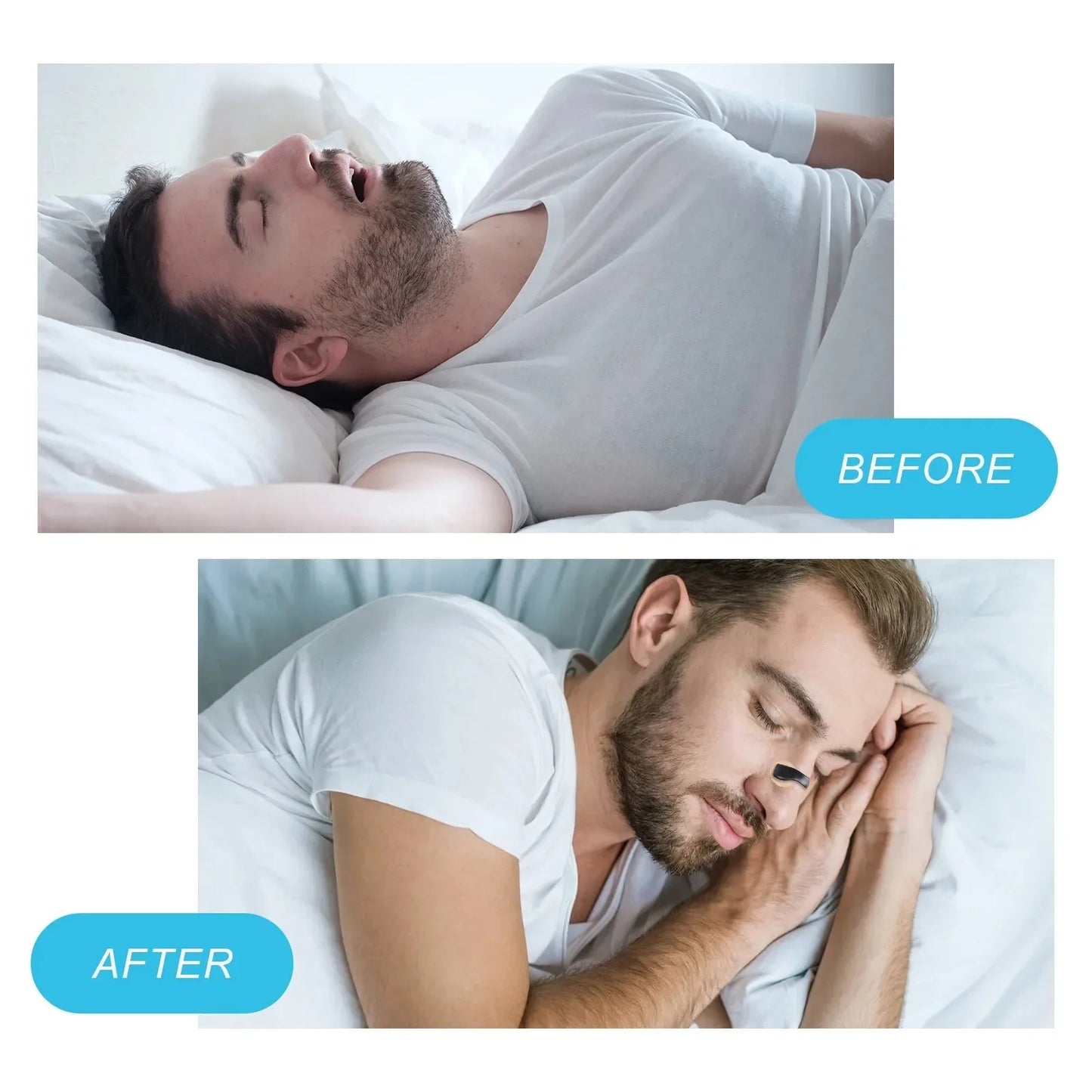 BreathEazy Magnetic Nose Strips Starter Kit